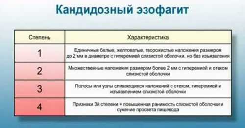 Определить воспаление пищевода в этом случае возможно только при осмотре специалиста